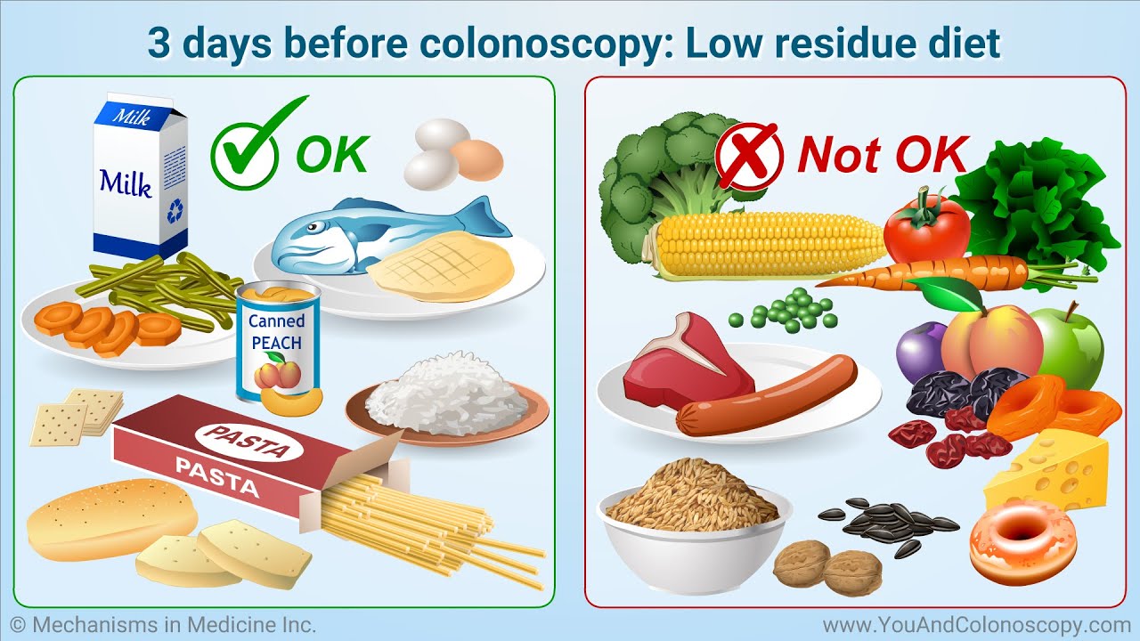 Colonoscopy Diet Image 2